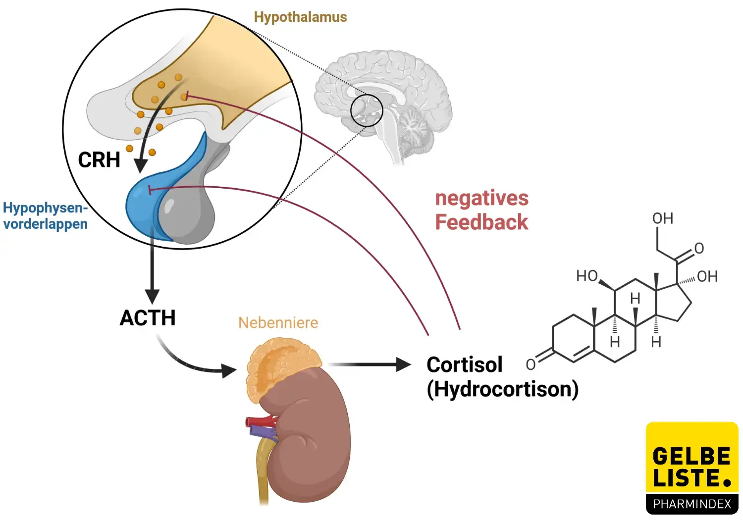 Glucocorticoide