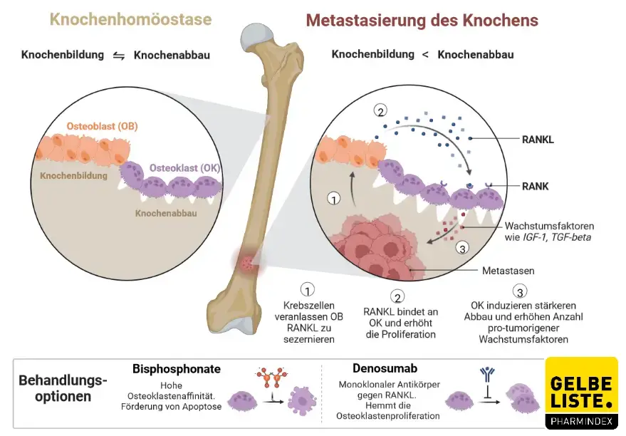 Denosumab Denosumab