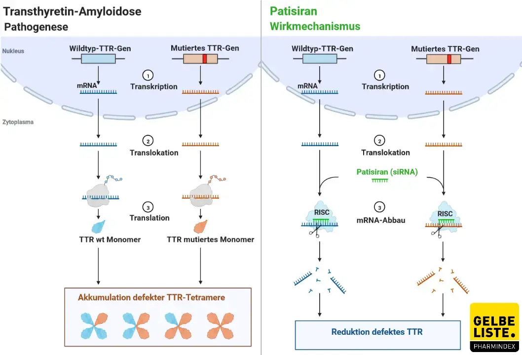 Patisiran Anwendung, Wirkung, Nebenwirkungen Gelbe Liste